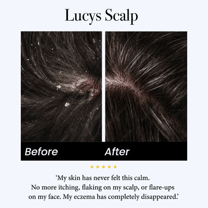 Natural Calming Serum